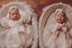 Алёна Ашмарина: Лучше провериться у хирурга