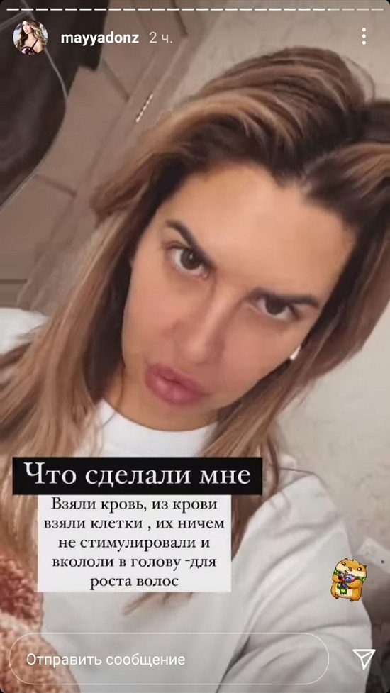 Майя Донцова: Очаговая алопеция