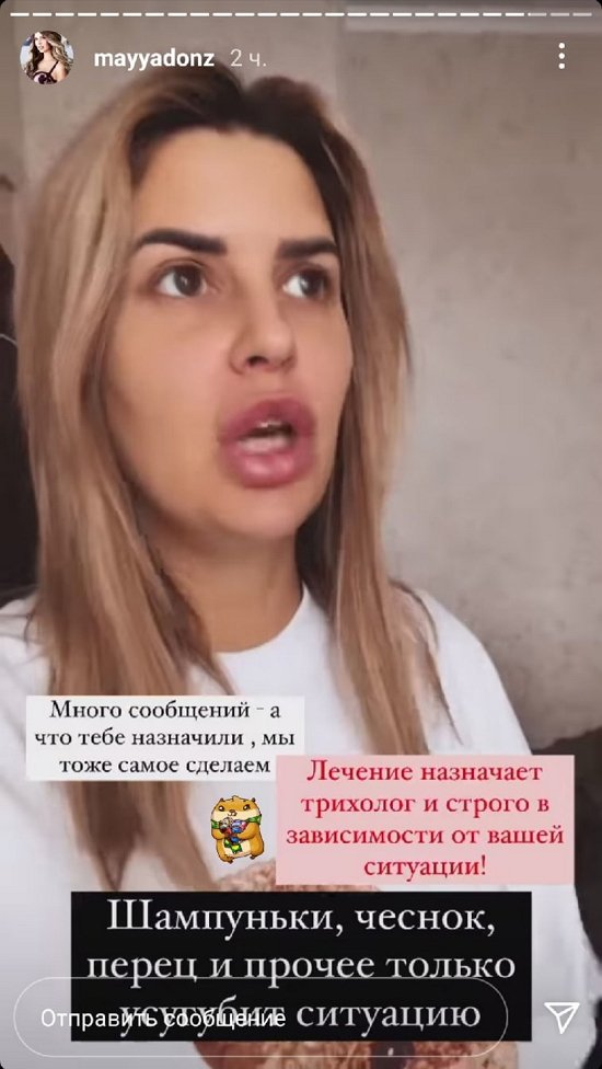 Майя Донцова: Очаговая алопеция