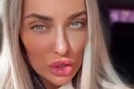 Юлия Жукова: Моему носу нужна корректировка