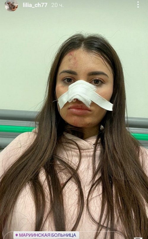 Лилия Четрару в поисках пластического хирурга
