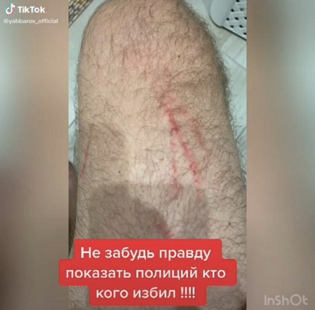 Илья Яббаров: Это такой позор!