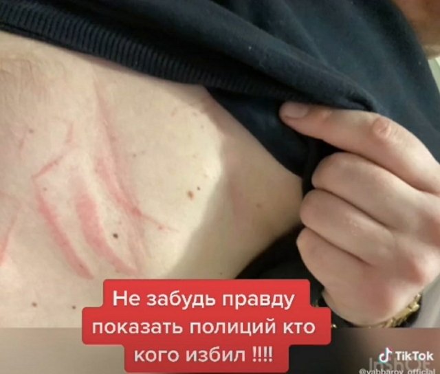 Илья Яббаров: Это такой позор!