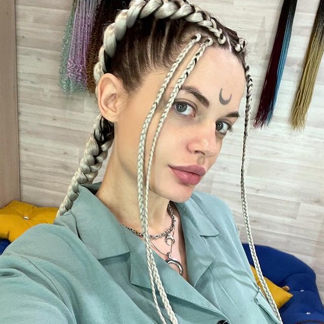 Селена Майер: Исправление дистального прикуса Селена Майер: Исправление дистального прикуса