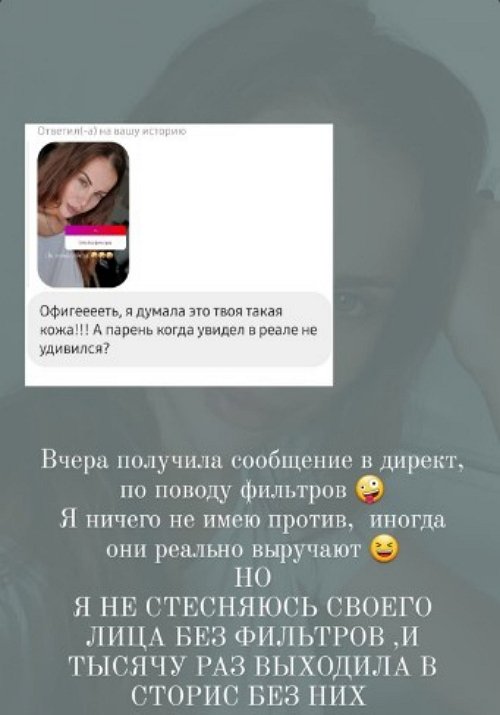 Ольга Ветер: Я сто раз выходила в сторис без фильтров