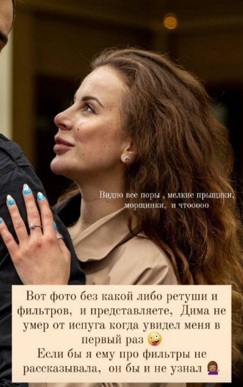 Ольга Ветер: Я сто раз выходила в сторис без фильтров