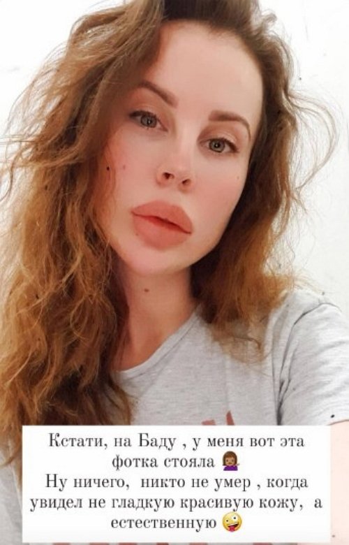 Ольга Ветер: Я сто раз выходила в сторис без фильтров