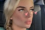 Екатерина Скалон: Сходила к врачу и расстроилась