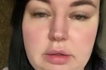 Александра Черно: Это метаболический синдром!