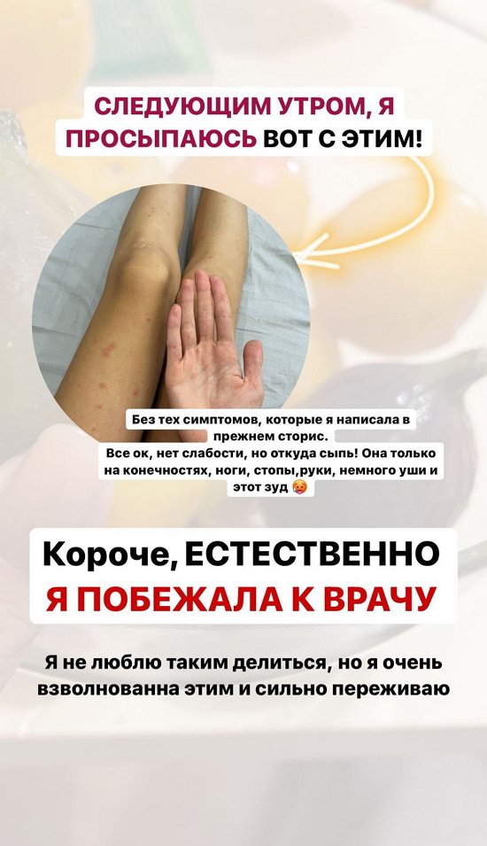 Ирина Пингвинова: Врач сказал, что это не заразно