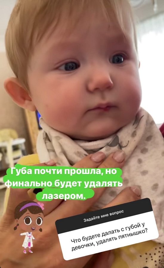 Алена Ашмарина: Губа почти прошла