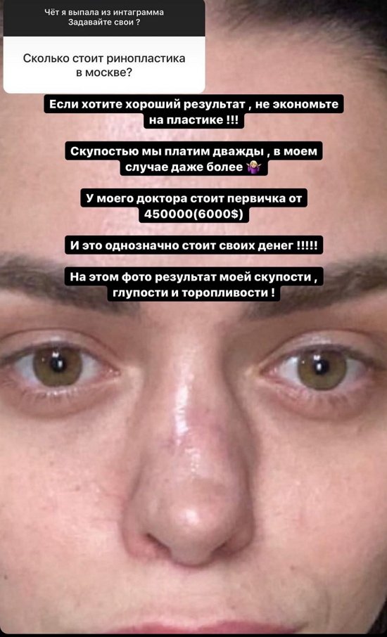 Анастасия Балинская: Он человечище!