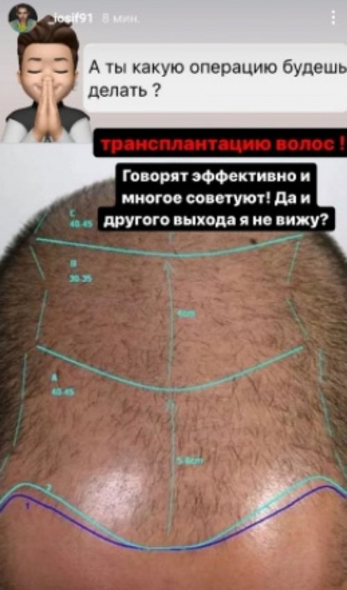 Иосиф Оганесян: После операции едем в Турцию вдвоём