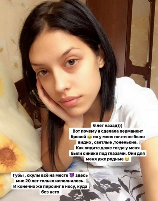 Анна Мадан: Даже тогда у меня были синяки под глазами