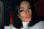 Анна Брянская: Делать губы или нет?