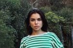 Алина Галимова: Кто делал подобные операции?