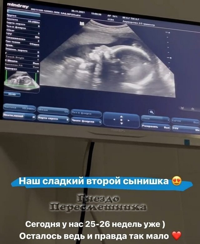 Алёна Савкина: Набор веса 7 кг Алёна Савкина: Набор веса 7 кг