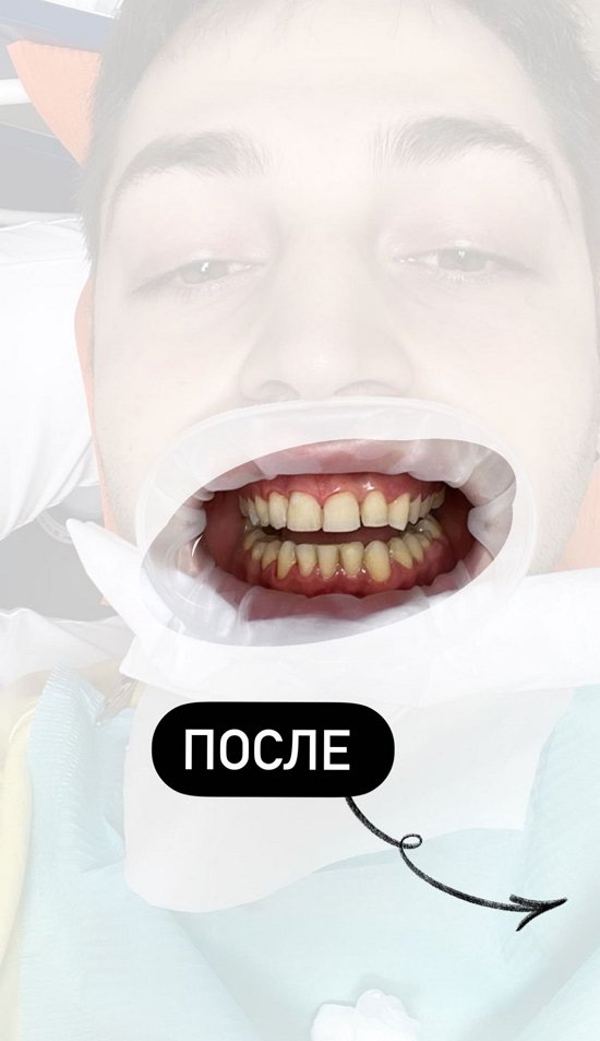 Иосиф Оганесян: Результат меня шокировал!