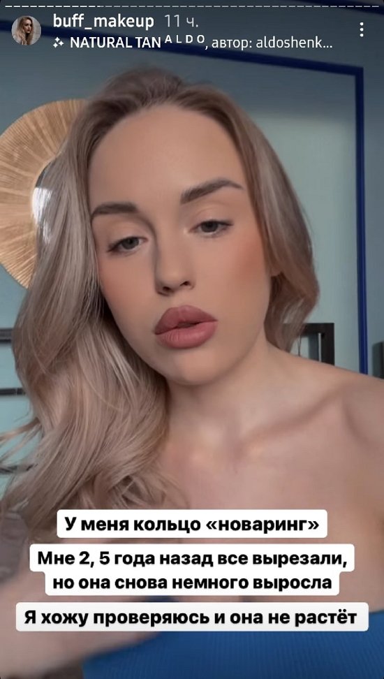 Милена Безбородова: У меня в груди обнаружили 4 фиброаденомы