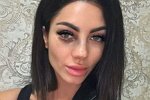 Анна Брянская: Как отёк полностью уйдёт, поеду к врачу