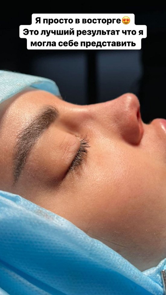 Яна Шафеева: У меня не дышит нос, совсем!