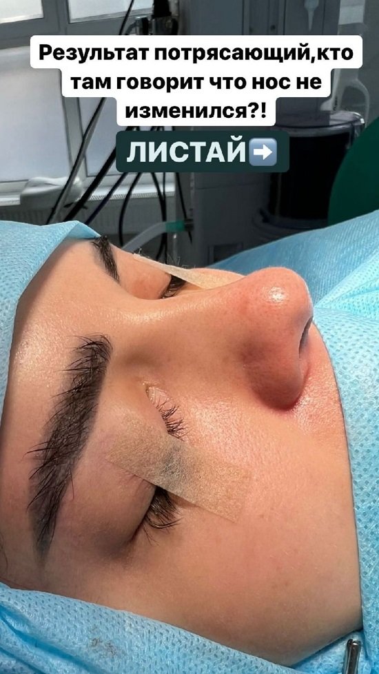 Яна Шафеева: У меня не дышит нос, совсем!