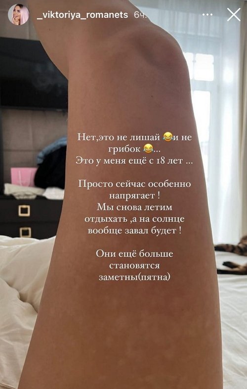 Виктория Романец: Сказали, что пройдет через 3 месяца
