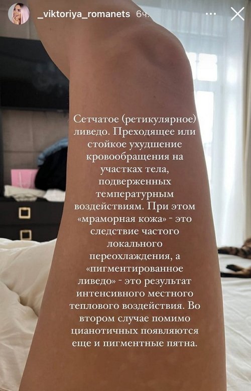 Виктория Романец: Сказали, что пройдет через 3 месяца