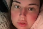 Александра Черно: Ждем врача, чтобы понять, что это