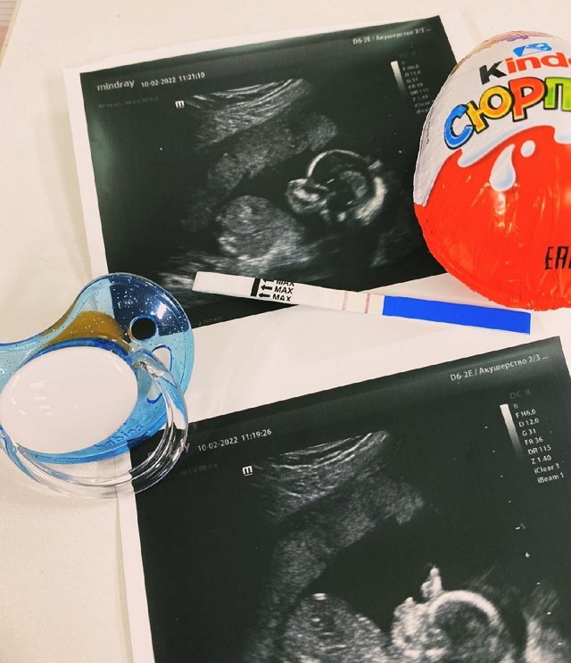 Татьяна Репина: Он у нас активный Татьяна Репина: Он у нас активный