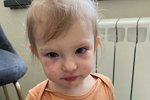 Элла Суханова: Глаза чесались, вся отекла и это случилось резко