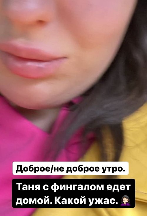 Младшую сестру Саши Оганесян избили в ночном клубе
