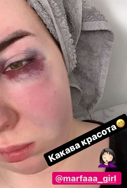 Младшую сестру Саши Оганесян избили в ночном клубе