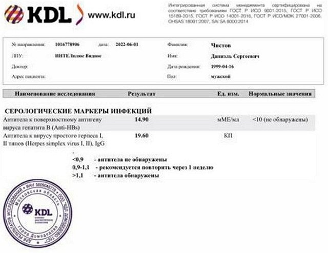 Даниэль Чистов: Сидим с Надей в полнейшем шоке Даниэль Чистов: Сидим с Надей в полнейшем шоке