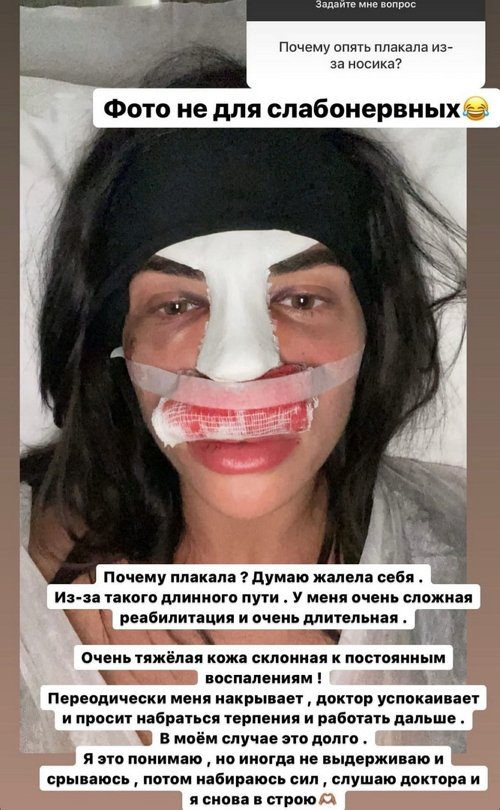 Анастасия Балинская: У меня очень сложная реабилитация