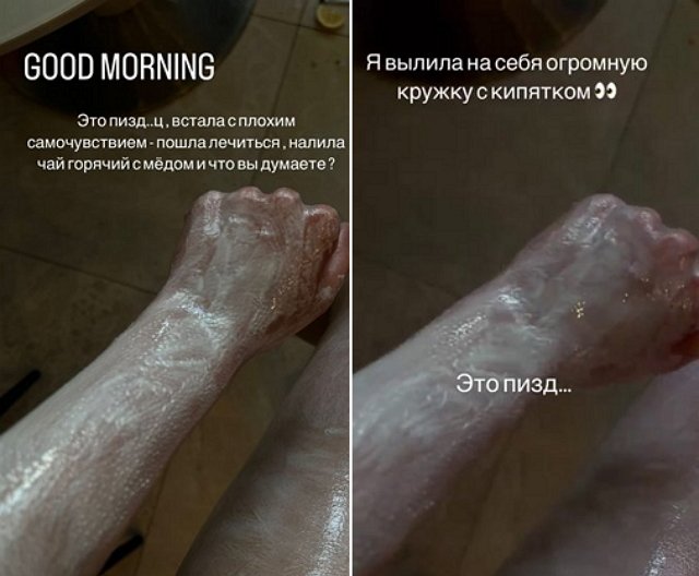 Алёна Савкина: Я вылила на себя огромную кружку 