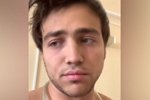 Антон Санников: Иду на поправку