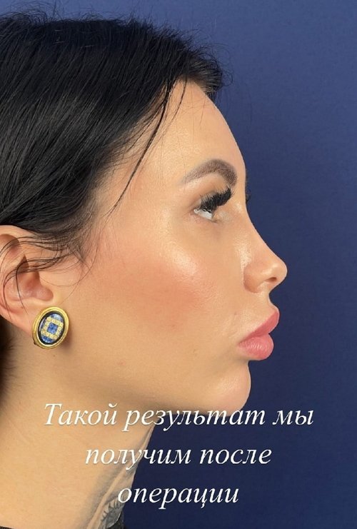 Клава Безверхова готовится к операции