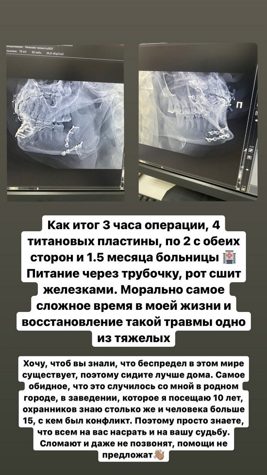 Захар Саленко: Это было без какой-либо обоснованной причины!