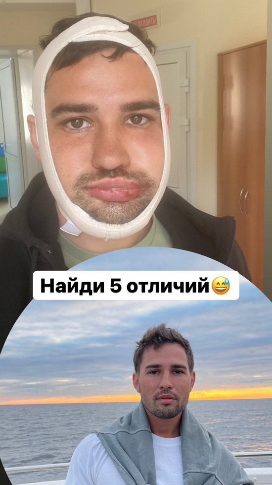 Захар Саленко: Это было без какой-либо обоснованной причины!