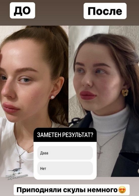 Татьяна Репина побывала у косметолога