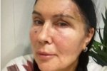 Татьяна Африкантова: Сейчас уже по улице бегаю!