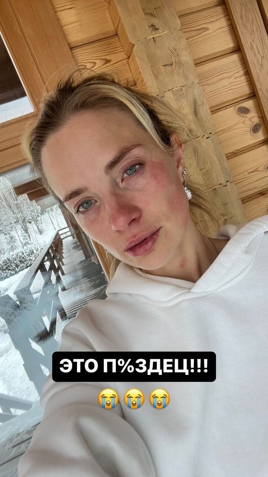 Кристина Черкасова: Слёзы и сопли текли не переставая