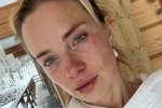 Кристина Черкасова: Слёзы и сопли текли не переставая