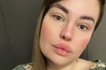 Александра Черно: Потрепала меня болезнь