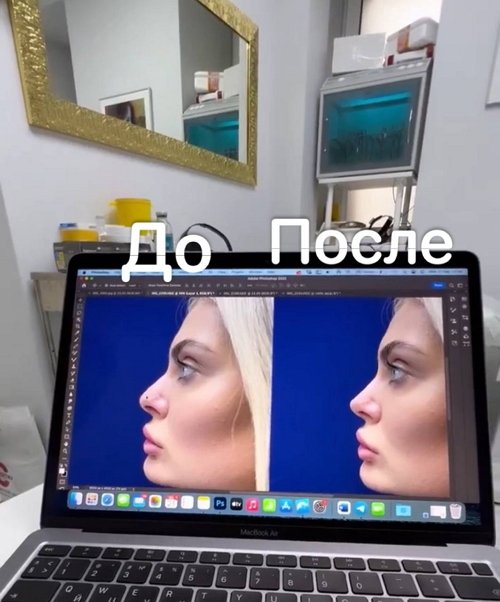 Юлия Жукова: Впереди у меня операция Юлия Жукова: Впереди у меня операция
