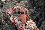 Александра Гозиас: Мыться больно, спать больно