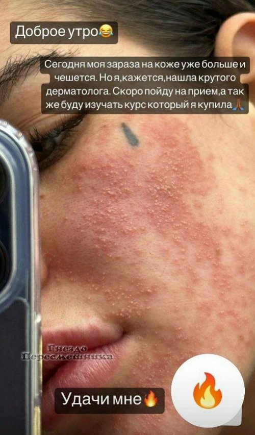 Алёна Опенченко: Мне просто нужен рецепт