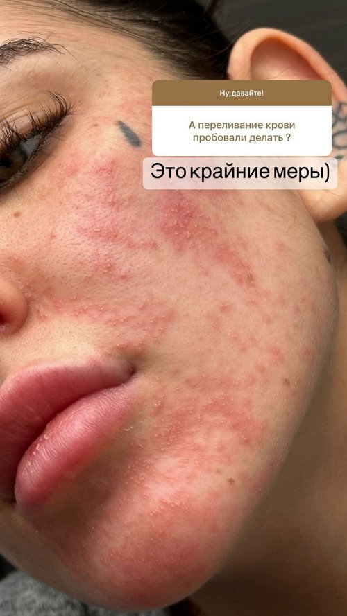 Алёна Опенченко: Мне просто нужен рецепт