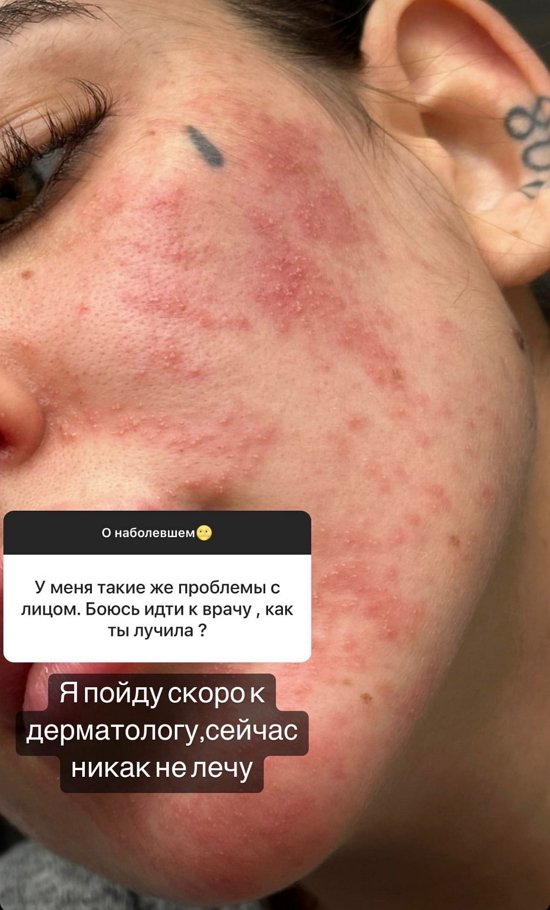 Алёна Опенченко: Пока непонятно...